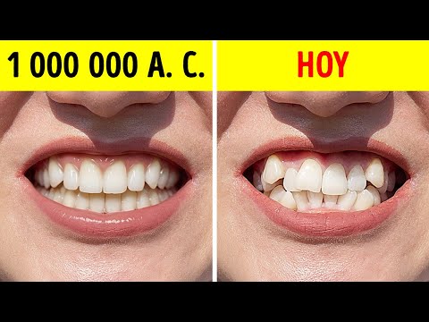 Por qué los humanos primitivos tenían dientes perfectamente rectos